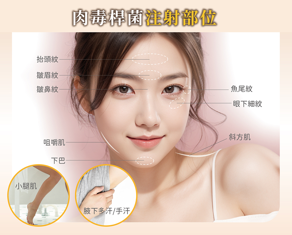 肉毒桿菌與玻尿酸微整形注射完整指南