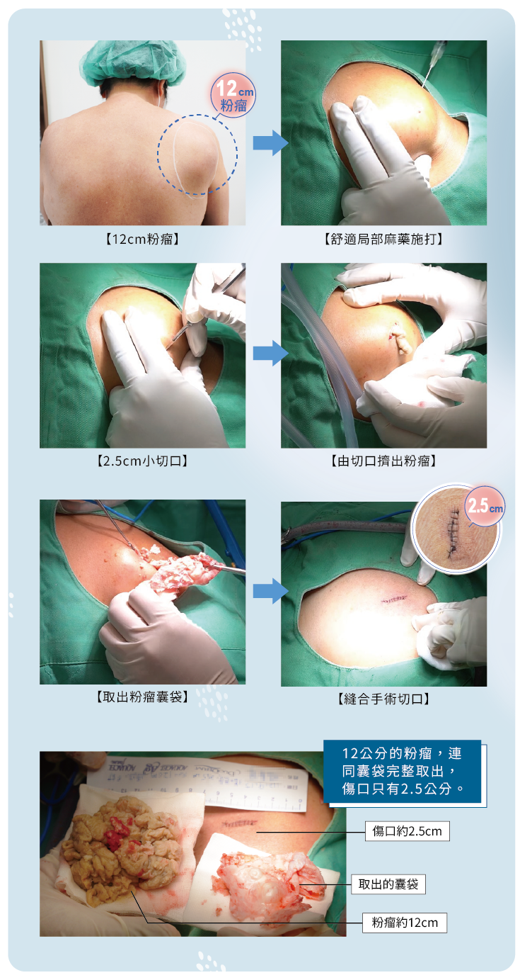 術後護理注意事項