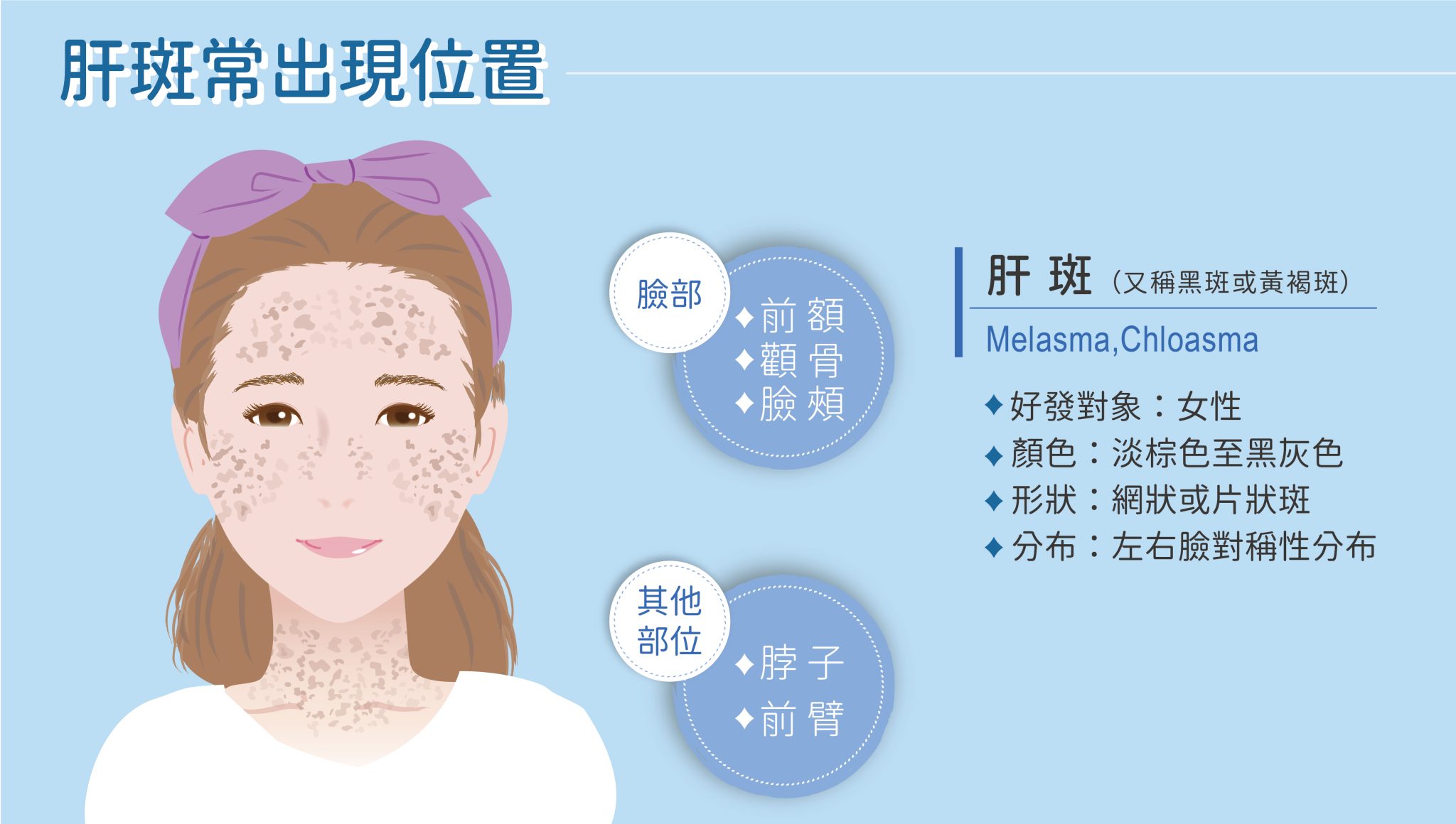 肝斑的位置分佈與臨床表現